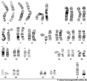 23 Chromosomen-Paare